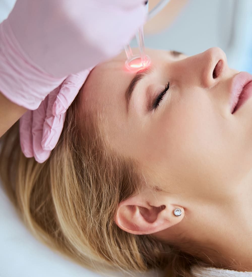 Fractional Laser Main PIC